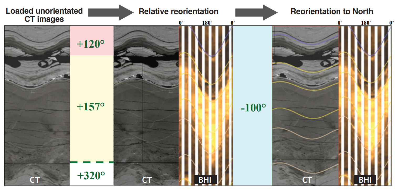 CT Scan integration workflow